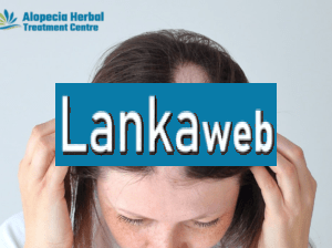 Best Alopecia Areata Treatment in Noida